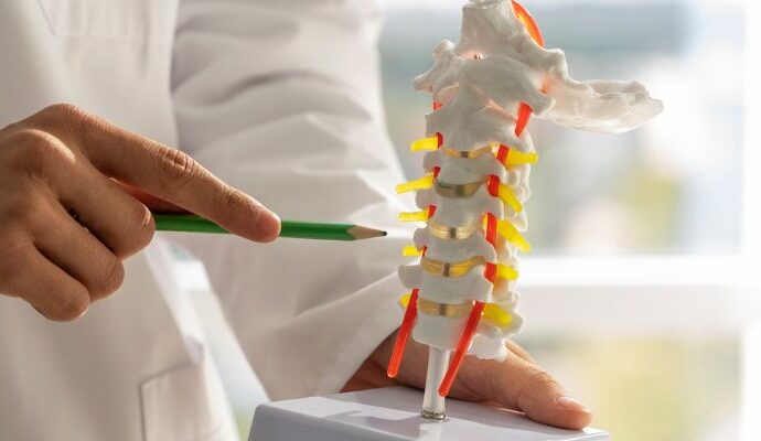 Spondylosis